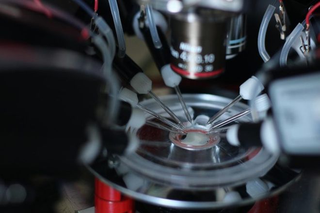 眠：科学家揭示大脑的夜间活动PP电子免费模拟器记忆与睡(图1)